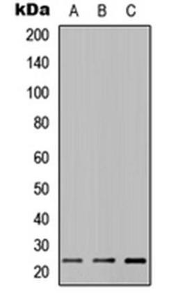 Western blot analysis of MCF7 (Lane1), H9C2 (Lane2), PC12 (Lane3) whole cell using CA125 antibody