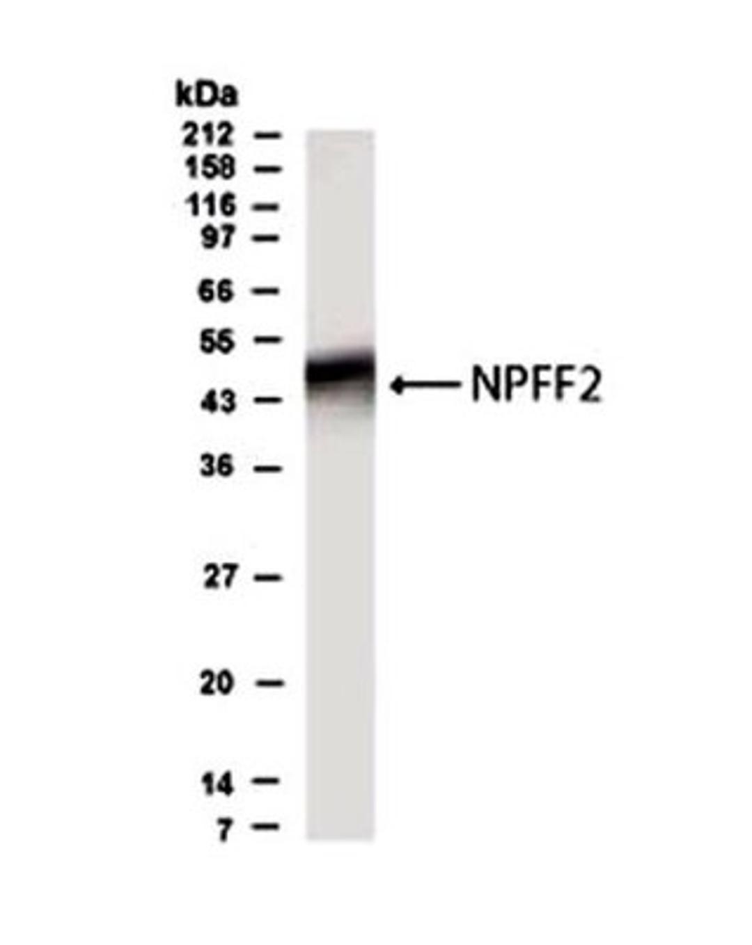 Western Blot: NPFFR2 Antibody [NB300-169] - Analysis of human NPFF2 in brain lysate using this antibody at a dilution of 1:500