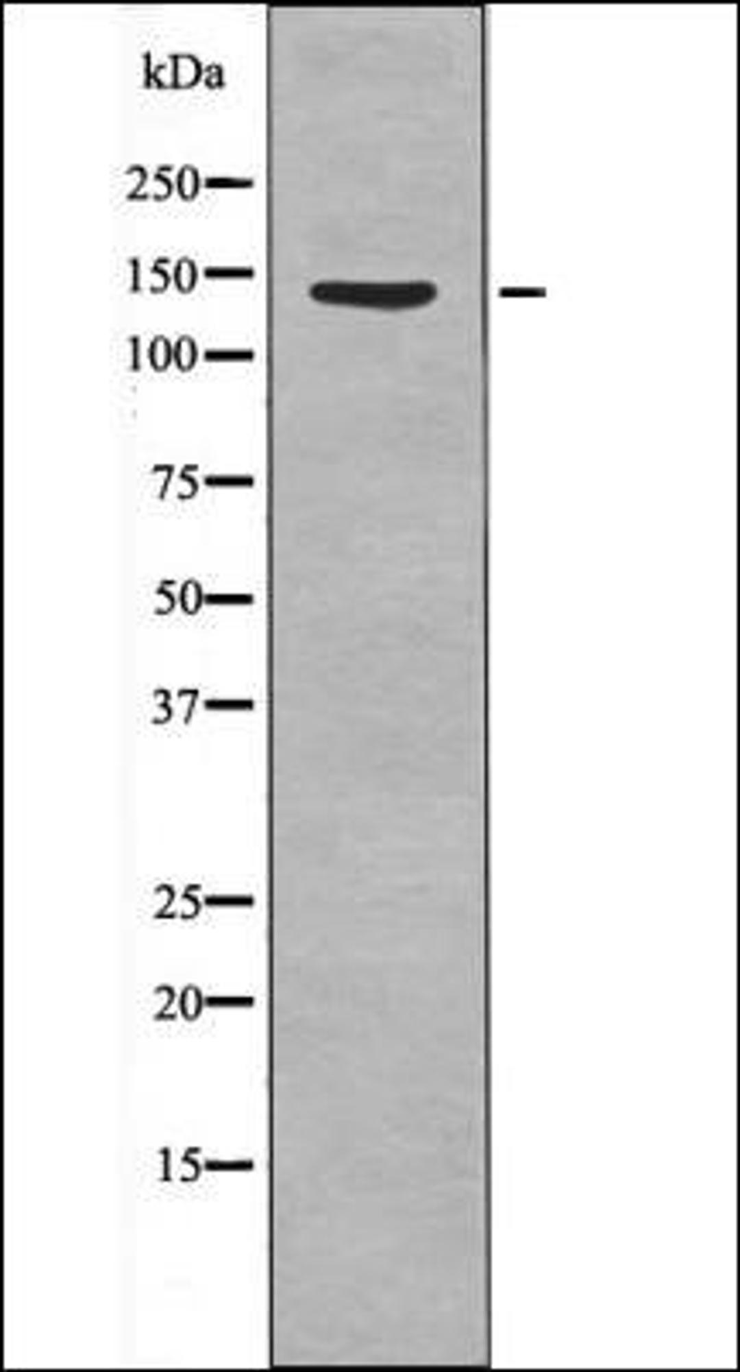 Western blot analysis of IL-4 treated HeLa whole cell lysates using QIK/QSK -Phospho-Thr175/163- antibody