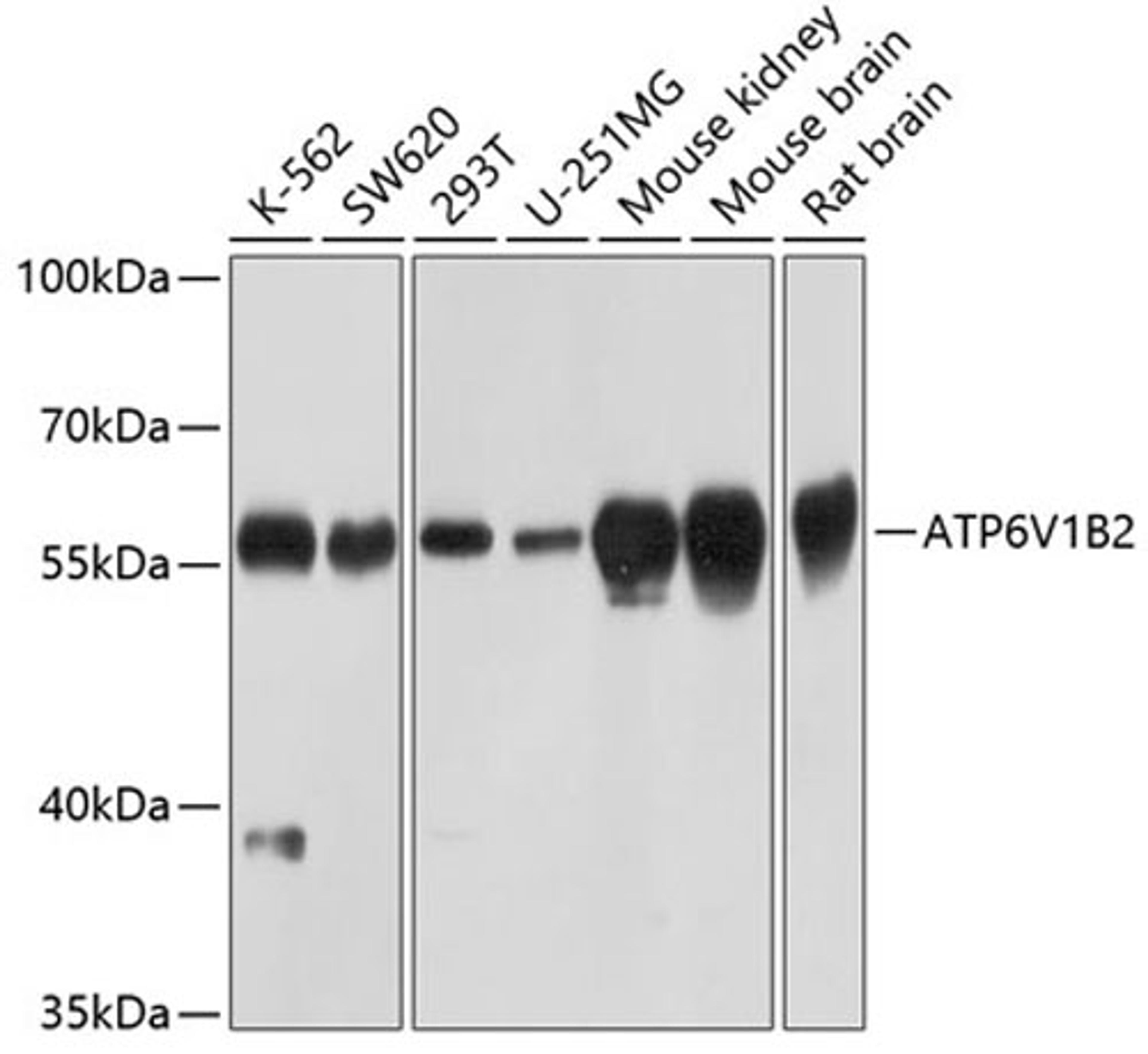 Western blot - ATP6V1B2 Antibody (A3754)