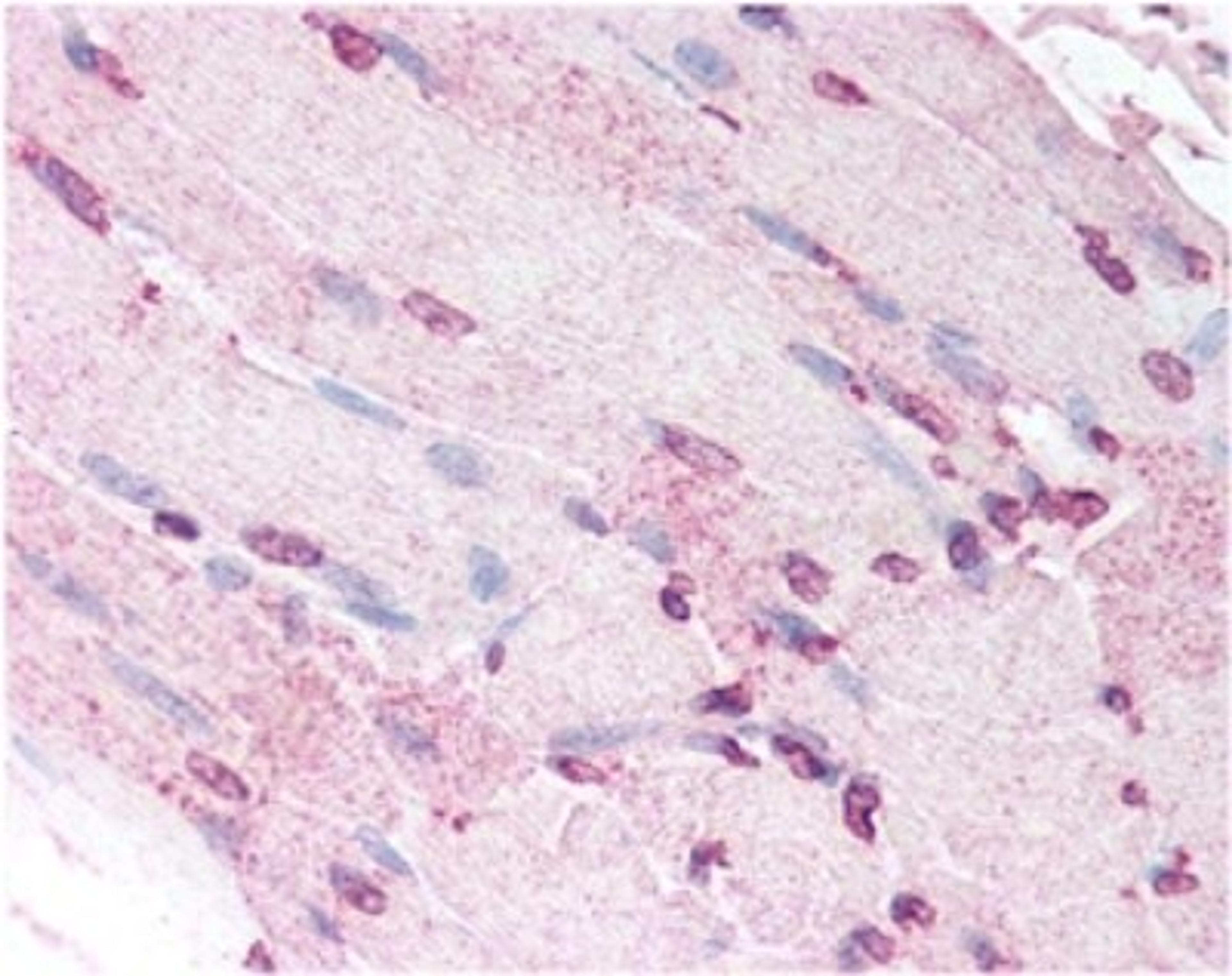 Immunohistochemistry: Defensin alpha 5 Antibody (8C8) [NB110-60002] - Human skeletal muscle myocytes showing moderate nuclear and faint cytoplasmic staining.