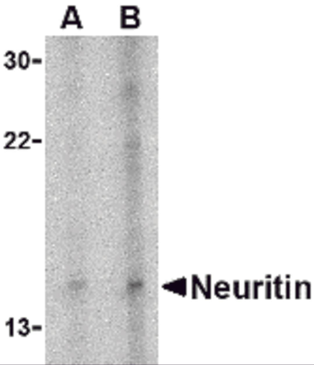 Western blot analysis of neuritin in Daudi cell lysate with neuritin antibody at (A) 5 and (B) 10 &#956;g/mL.