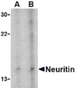 Western blot analysis of neuritin in Daudi cell lysate with neuritin antibody at (A) 5 and (B) 10 μg/mL.