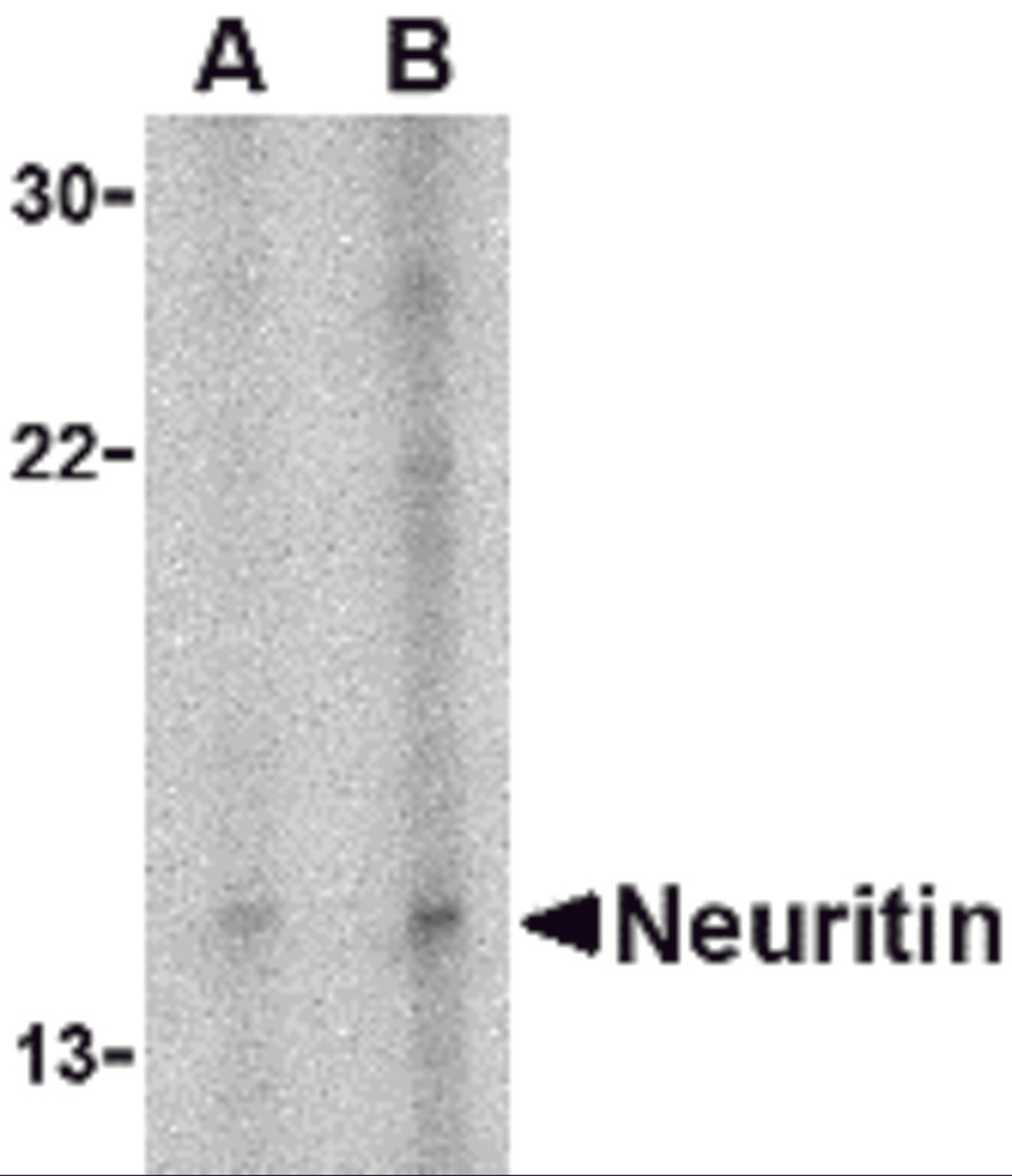 Western blot analysis of neuritin in Daudi cell lysate with neuritin antibody at (A) 5 and (B) 10 μg/mL.