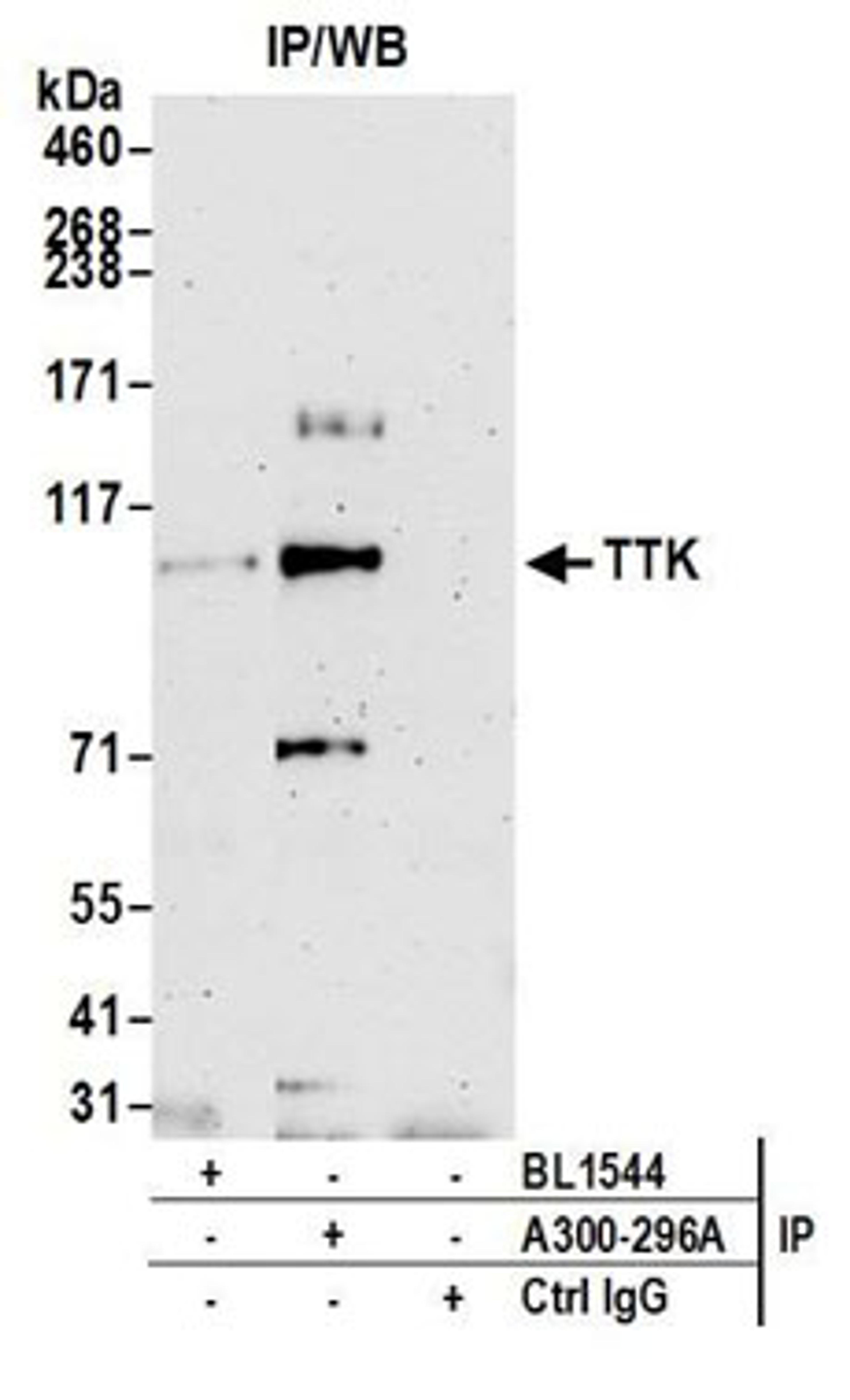 Detection of human TTK by western blot of immunoprecipitates.