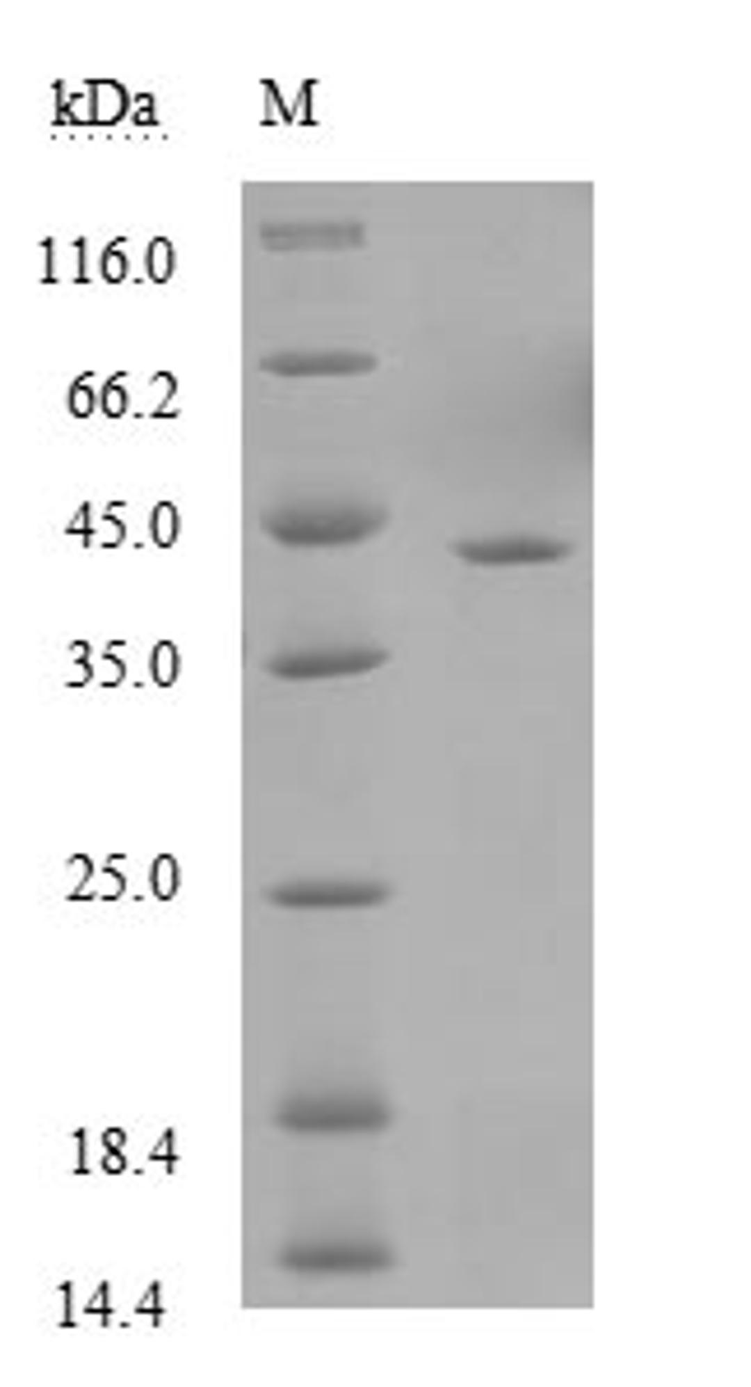 (Tris-Glycine gel) Discontinuous SDS-PAGE (reduced) with 5% enrichment gel and 15% separation gel.