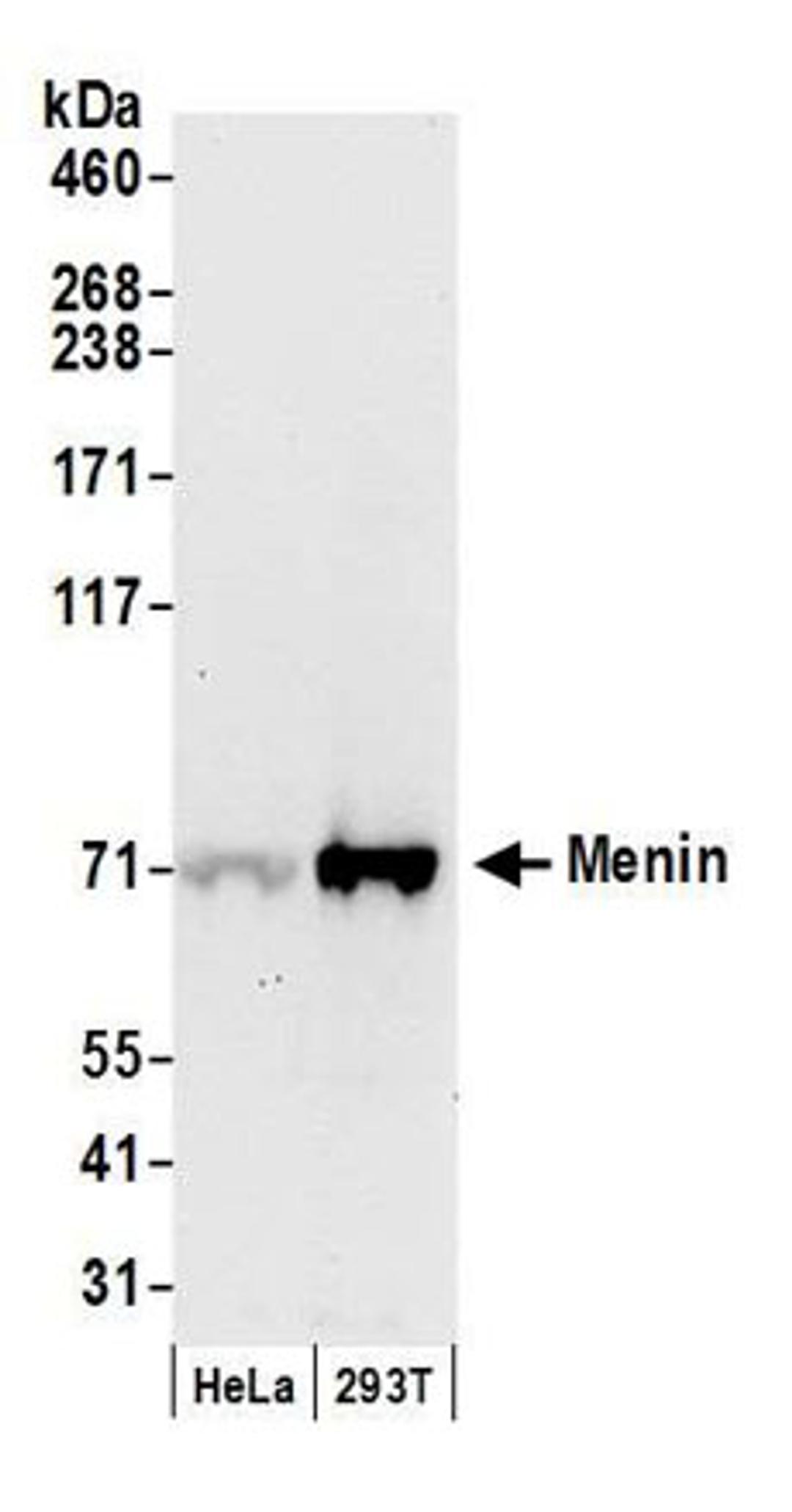 Detection of human Menin by western blot.