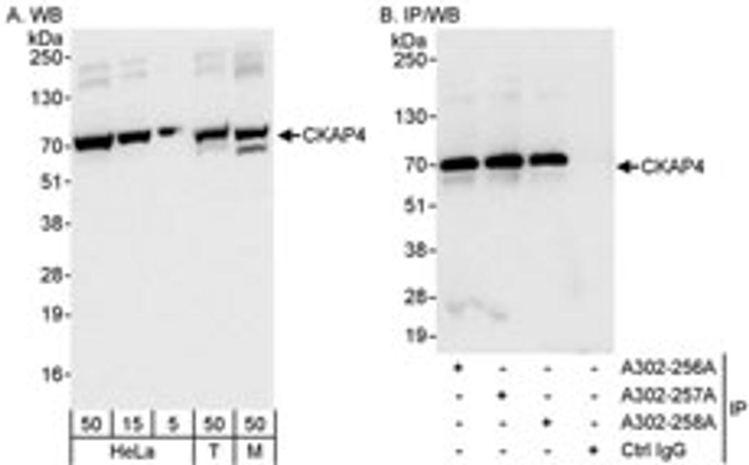 Detection of human and mouse CKAP4 by western blot (h&m) and immunoprecipitation (h).