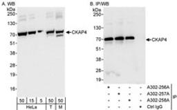 Detection of human and mouse CKAP4 by western blot (h&m) and immunoprecipitation (h).