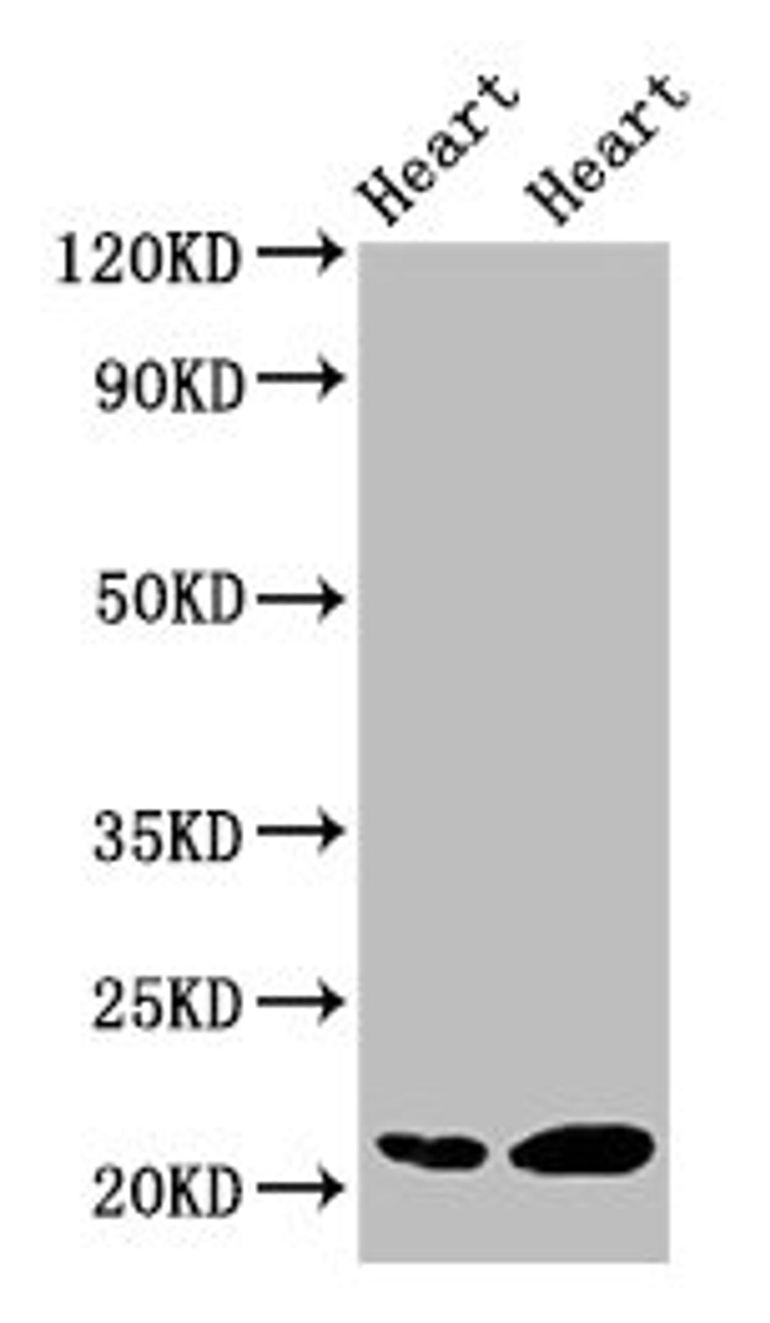 Western Blot. Positive WB detected in: Rat heart tissue, Mouse heart tissue. All lanes: CRYAB antibody at 2µg/ml. Secondary. Goat polyclonal to rabbit IgG at 1/50000 dilution. Predicted band size: 21 kDa. Observed band size: 21 kDa