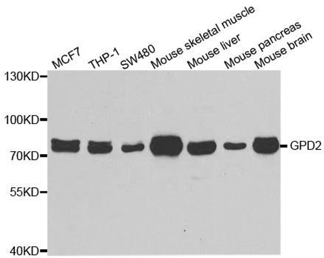 Western blot analysis of extracts of various cell lines using GPD2 antibody