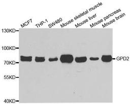 Western blot analysis of extracts of various cell lines using GPD2 antibody