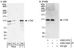 Detection of human c-Cbl by western blot and immunoprecipitation.