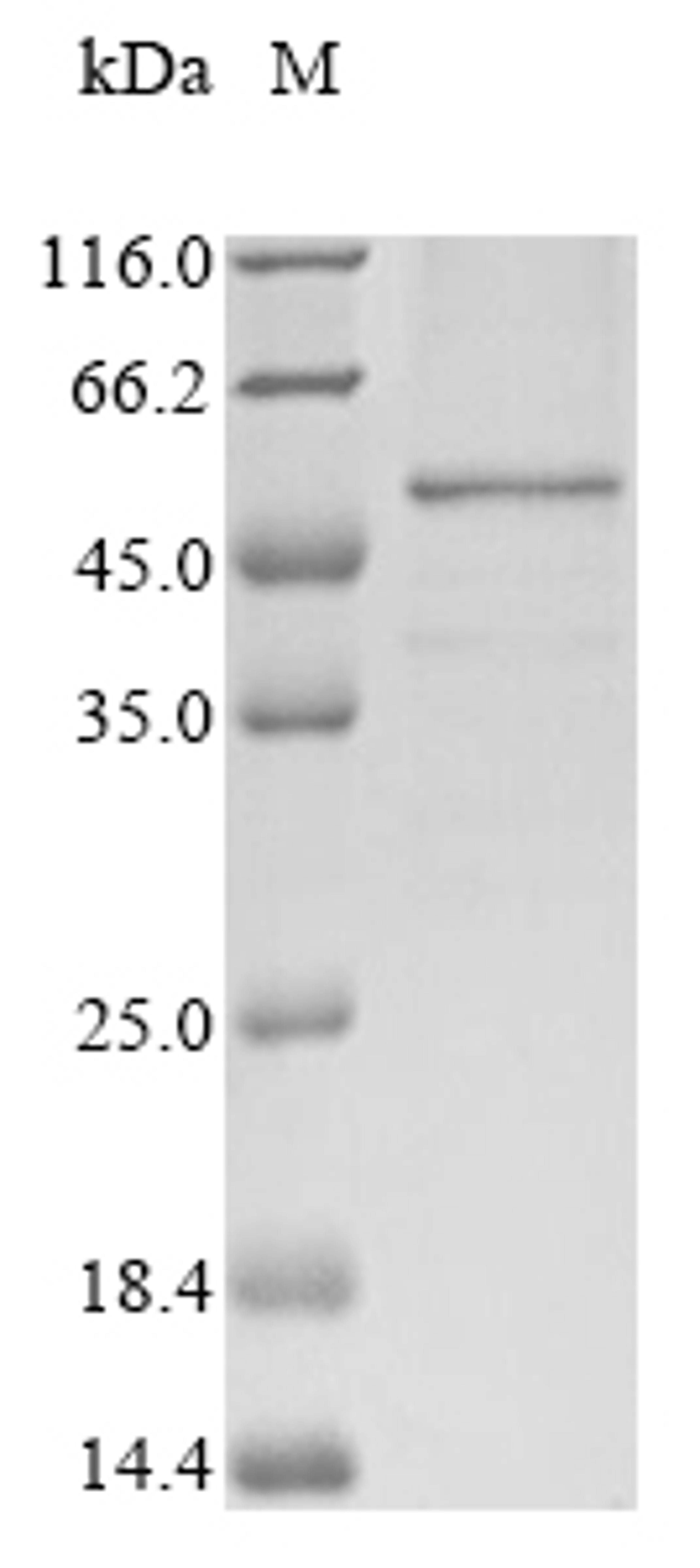 (Tris-Glycine gel) Discontinuous SDS-PAGE (reduced) with 5% enrichment gel and 15% separation gel.