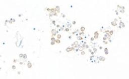 Detection of human TIM3 by immunohistochemistry.