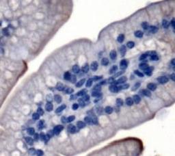 Immunohistochemistry: Niemann-Pick type C1 Like-1 Antibody [NB400-127] - Staining of Niemann-Pick type C1 Like-1 in mouse intestine using NB400-127.