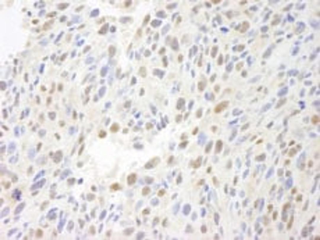 Detection of mouse MCAF by immunohistochemistry.