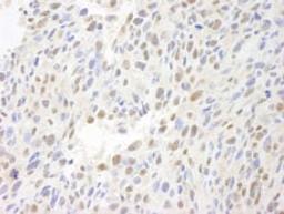 Detection of mouse MCAF by immunohistochemistry.