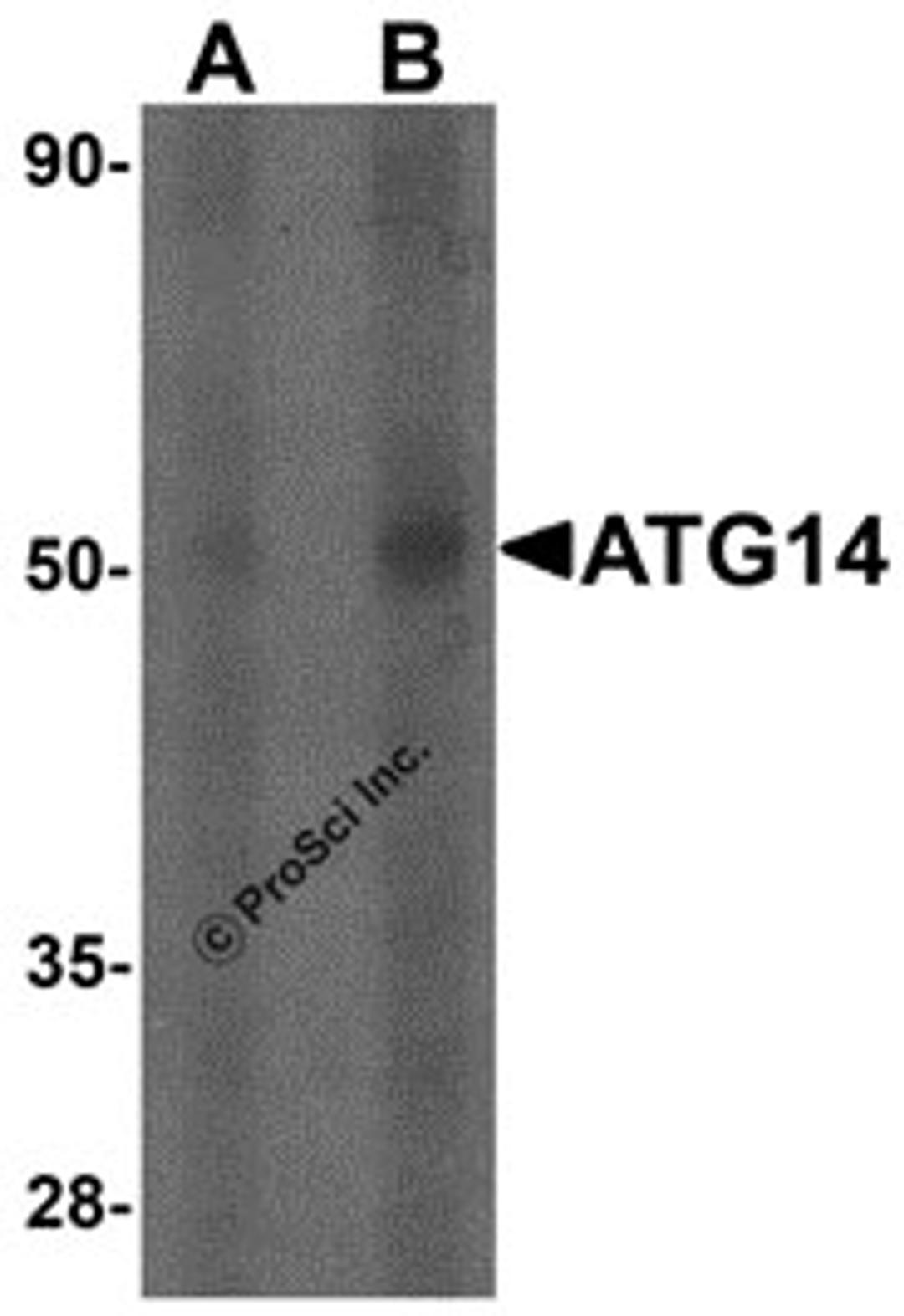 Western blot analysis of ATG14 in human small intestine tissue lysate with ATG14 antibody at (A) 1 and (B) 2 μg/mL.