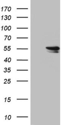 Western Blot: hHR23b Antibody (7G10) [NBP2-45514] - Analysis of HEK293T cells were transfected with the pCMV6-ENTRY control (Left lane) or pCMV6-ENTRY hHR23b.