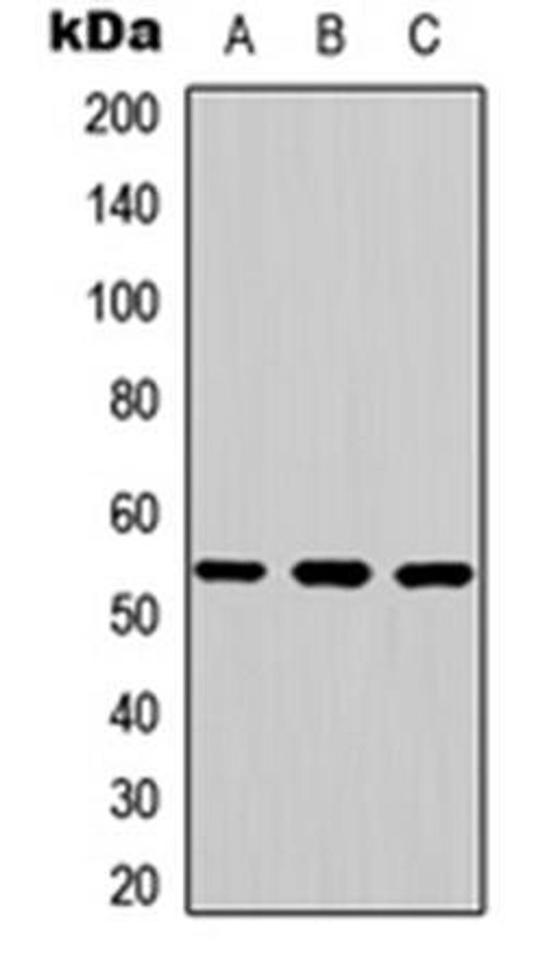 Western blot analysis of K562 (Lane1), mouse brain (Lane2), rat brain (Lane3) whole cell using JNK2 antibody