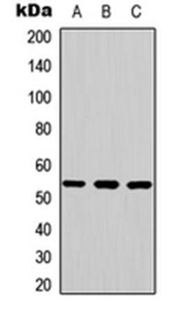 Western blot analysis of K562 (Lane1), mouse brain (Lane2), rat brain (Lane3) whole cell using JNK2 antibody