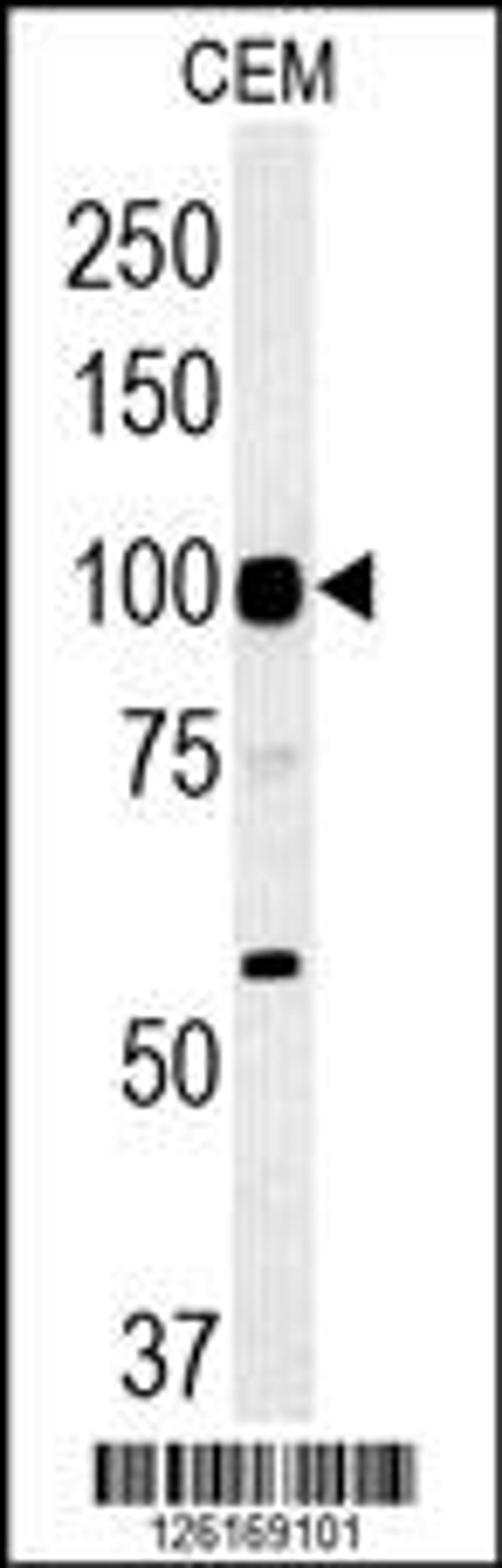 Western blot analysis in CEM cell line lysates (35ug/lane).