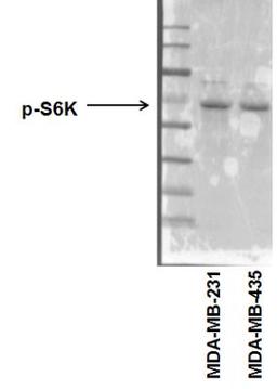 Western Blot: p70 S6 Kinase/S6K [p Thr389] Antibody [NB600-1049] - analysis of phospho-p70 S6 Kinase in human breast cancer cell lines (MDA-MB-231 and MDA-MB-435) using anti-p70 S6 Kinase [p Thr389] antibody. Image from verified customer review.