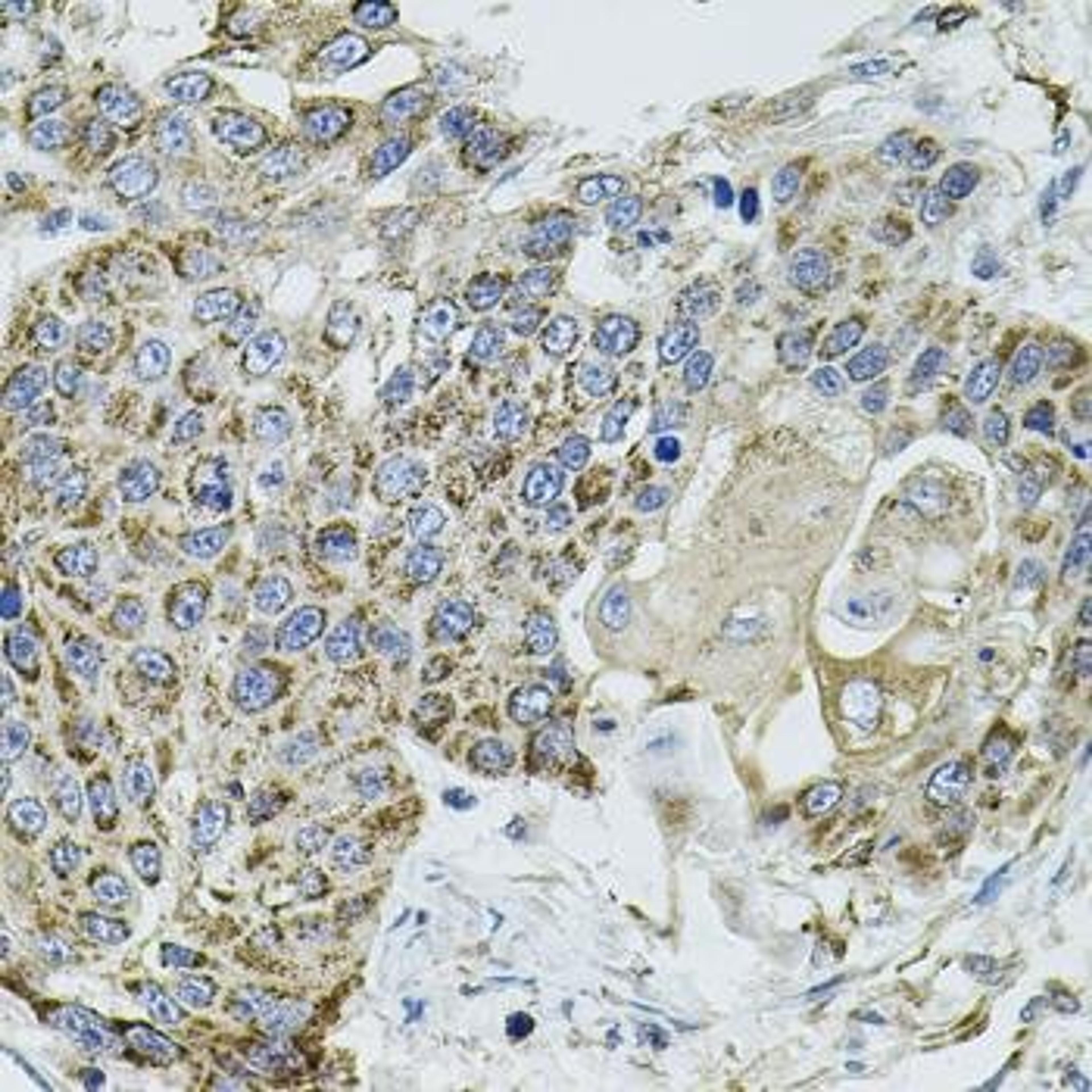 Immunohistochemical staining of mouse brain tissue using VEPH1 antibody