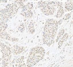 Detection of human B-Myb by immunohistochemistry.