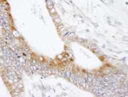 Detection of human MAP7 by immunohistochemistry.