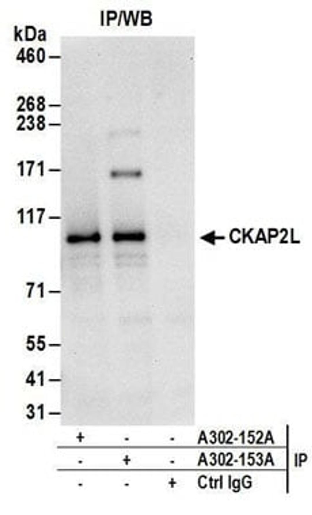 Detection of human CKAP2L by western blot of immunoprecipitates.