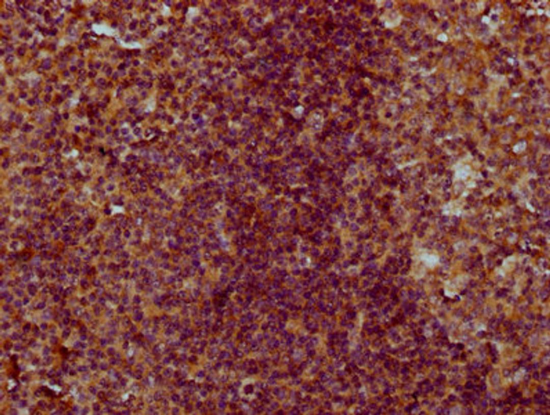 IHC image of CSB-PA005641LA01HU diluted at 1:300 and staining in paraffin-embedded human tonsil tissue performed on a Leica BondTM system. After dewaxing and hydration, antigen retrieval was mediated by high pressure in a citrate buffer (pH 6.0). Section was blocked with 10% normal goat serum 30min at RT. Then primary antibody (1% BSA) was incubated at 4°C overnight. The primary is detected by a biotinylated secondary antibody and visualized using an HRP conjugated SP system.