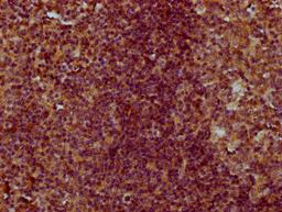 IHC image of CSB-PA005641LA01HU diluted at 1:300 and staining in paraffin-embedded human tonsil tissue performed on a Leica BondTM system. After dewaxing and hydration, antigen retrieval was mediated by high pressure in a citrate buffer (pH 6.0). Section was blocked with 10% normal goat serum 30min at RT. Then primary antibody (1% BSA) was incubated at 4°C overnight. The primary is detected by a biotinylated secondary antibody and visualized using an HRP conjugated SP system.