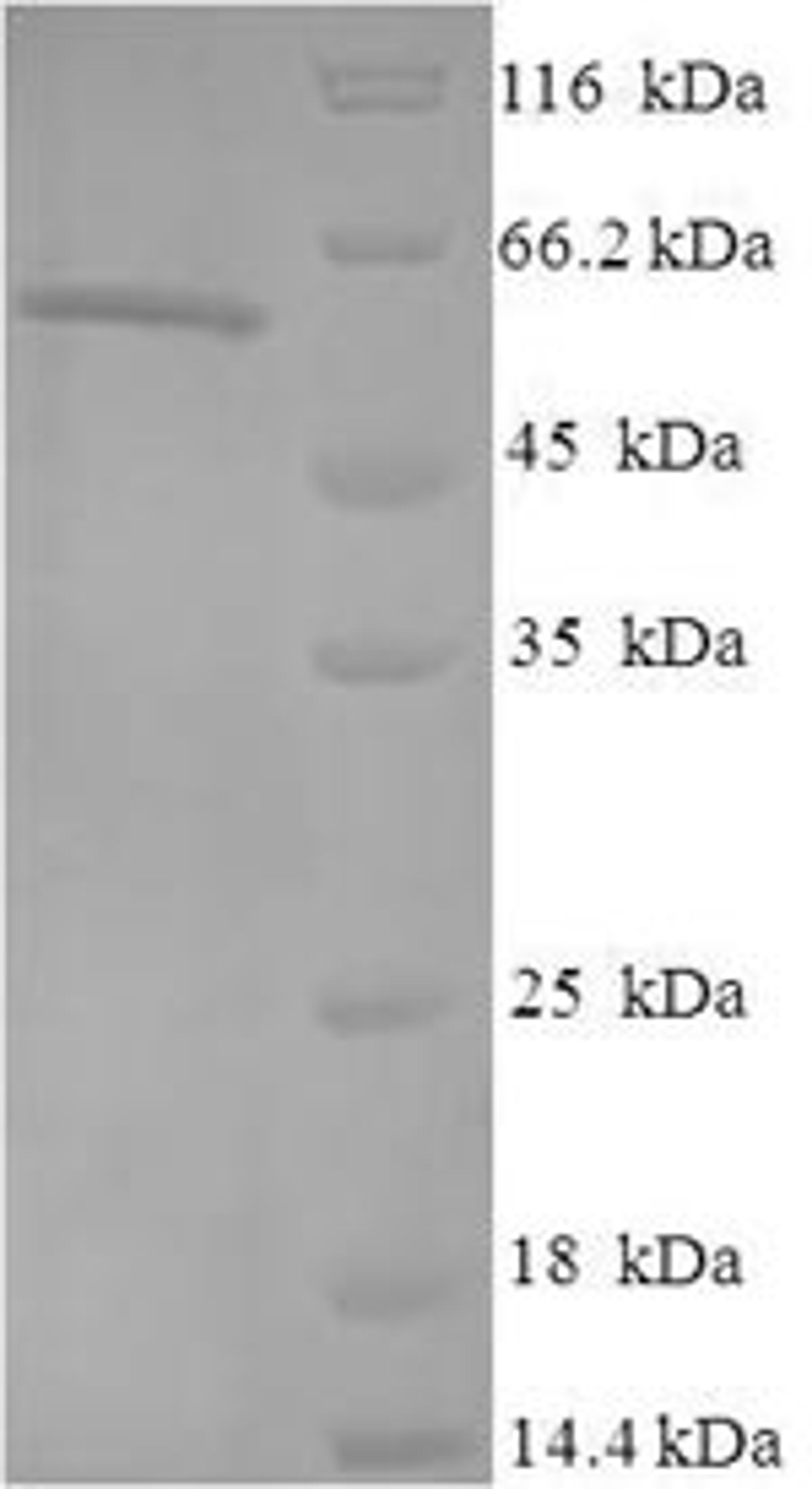 (Tris-Glycine gel) Discontinuous SDS-PAGE (reduced) with 5% enrichment gel and 15% separation gel.
