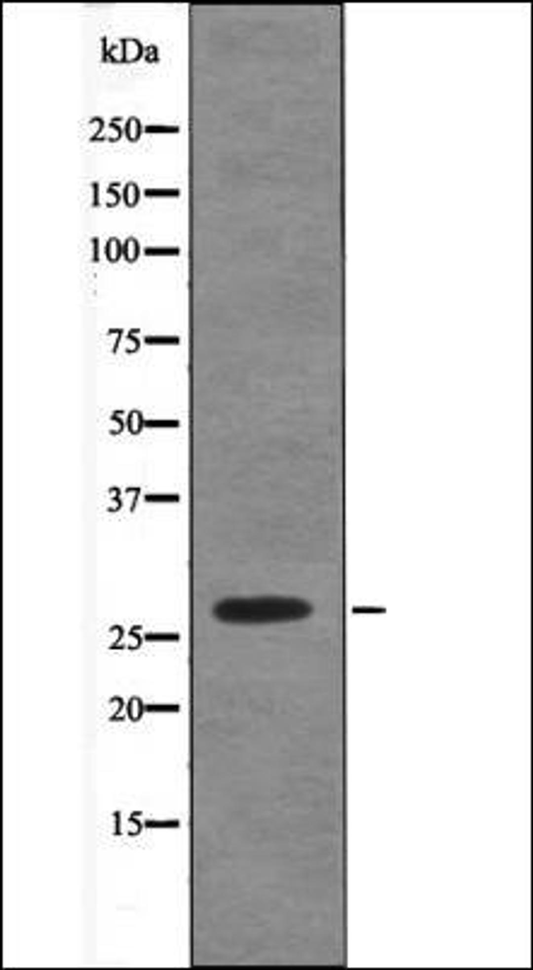 Western blot analysis of COS7 whole cell lysates using Caveolin 2 -Phospho-Ser23- antibody