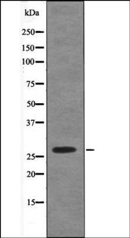 Western blot analysis of COS7 whole cell lysates using Caveolin 2 -Phospho-Ser23- antibody