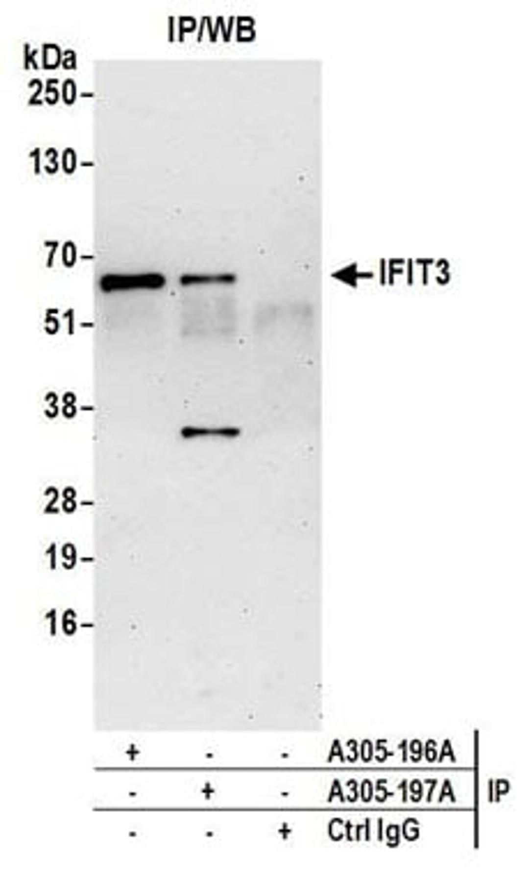 Detection of human IFIT3 by western blot of immunoprecipitates.