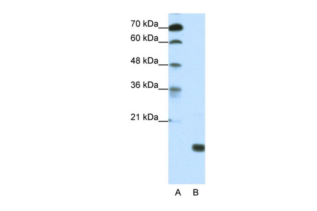 Antibody used in WB on Human HepG2 at 1.25 ug/ml.