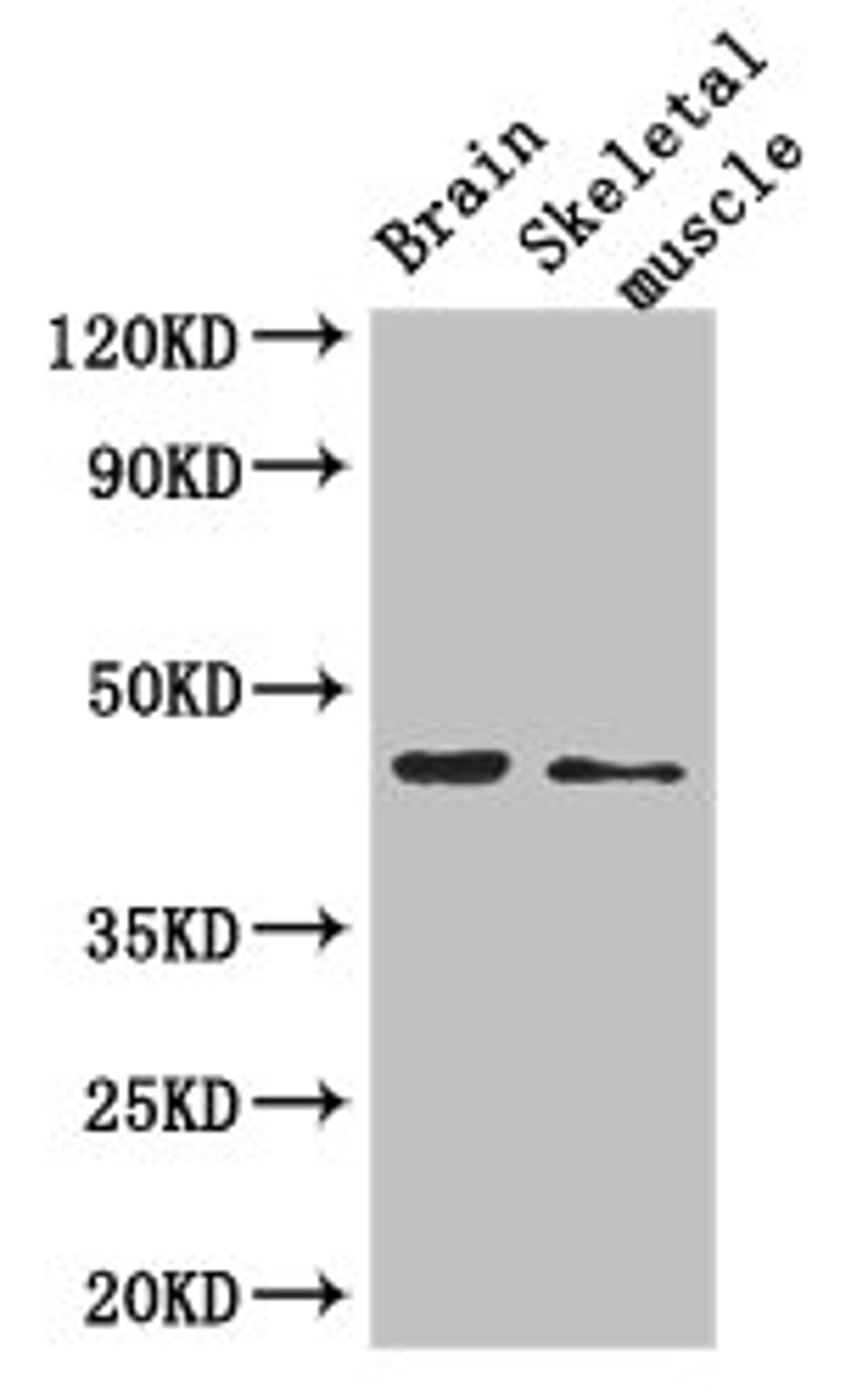 Western Blot. Positive WB detected in: Mouse brain tissue, Mouse skeletal muscle tissue. All lanes: AJAP1 antibody at 2.7ug/ml. Secondary. Goat polyclonal to rabbit IgG at 1/50000 dilution. Predicted band size: 45 kDa. Observed band size: 45 kDa. 