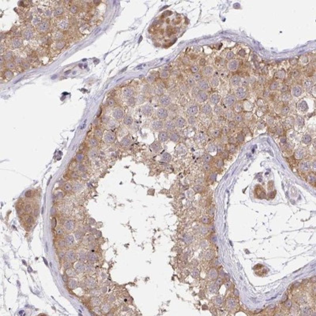 Immunohistochemistry: C19orf54 Antibody [NBP2-32418] - Staining of human testis shows moderate cytoplasmic positivity in cells in seminiferus ducts and Leydig cells.