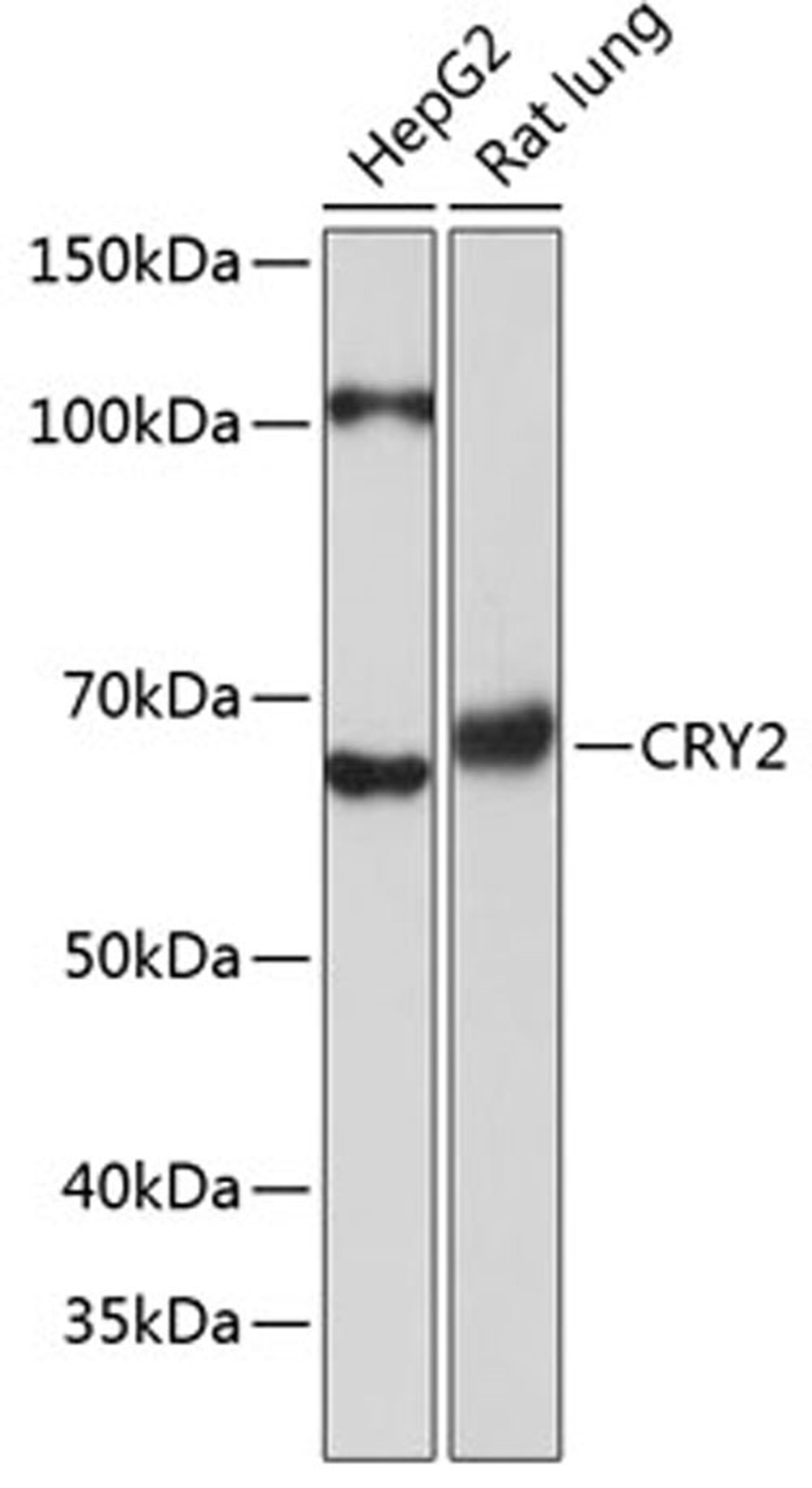 Western blot - CRY2 Polyclonal Antibody (A17465)