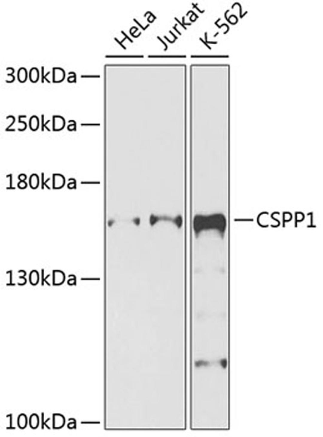 Western blot - CSPP1 antibody (A9983)