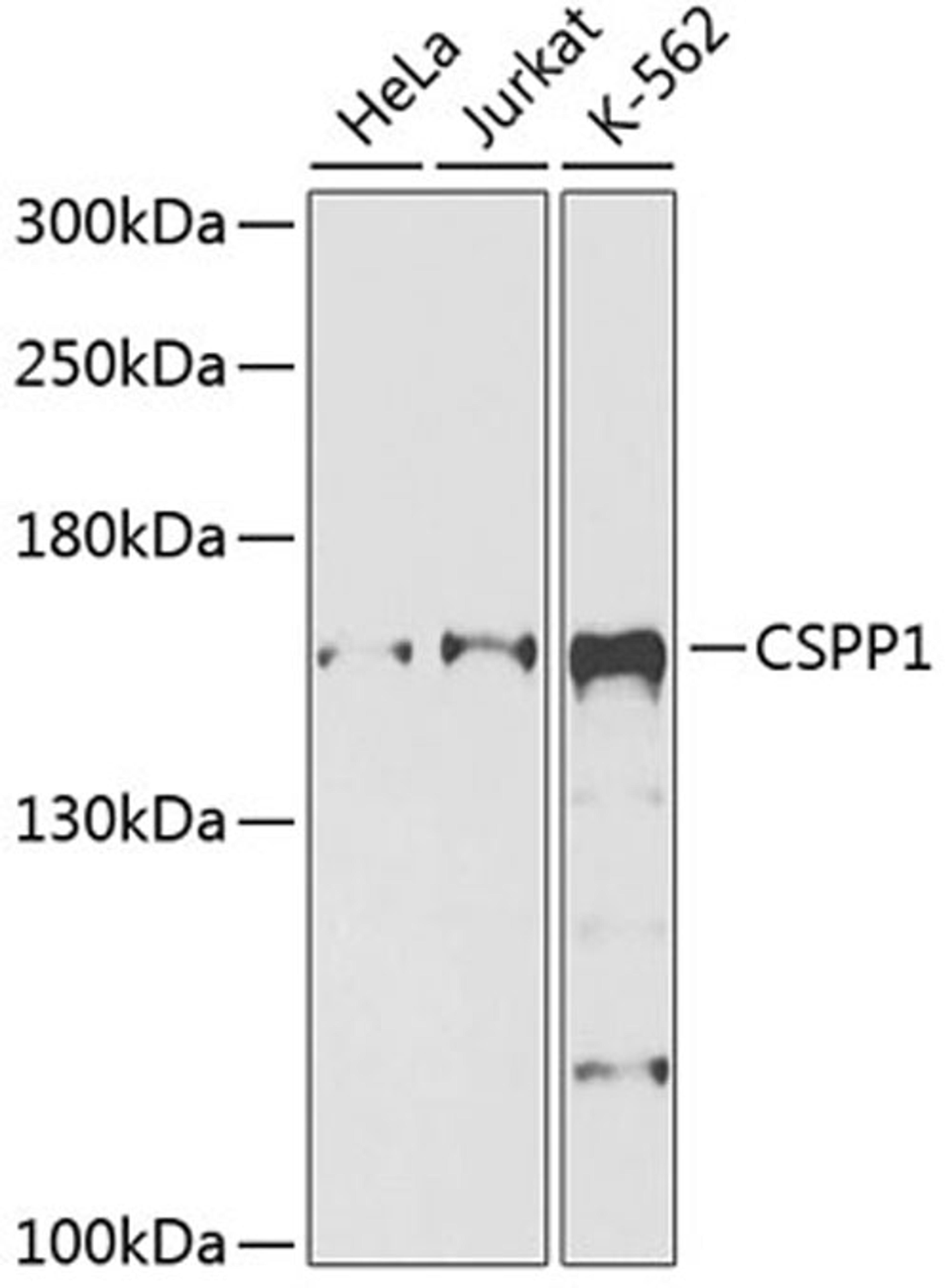 Western blot - CSPP1 antibody (A9983)