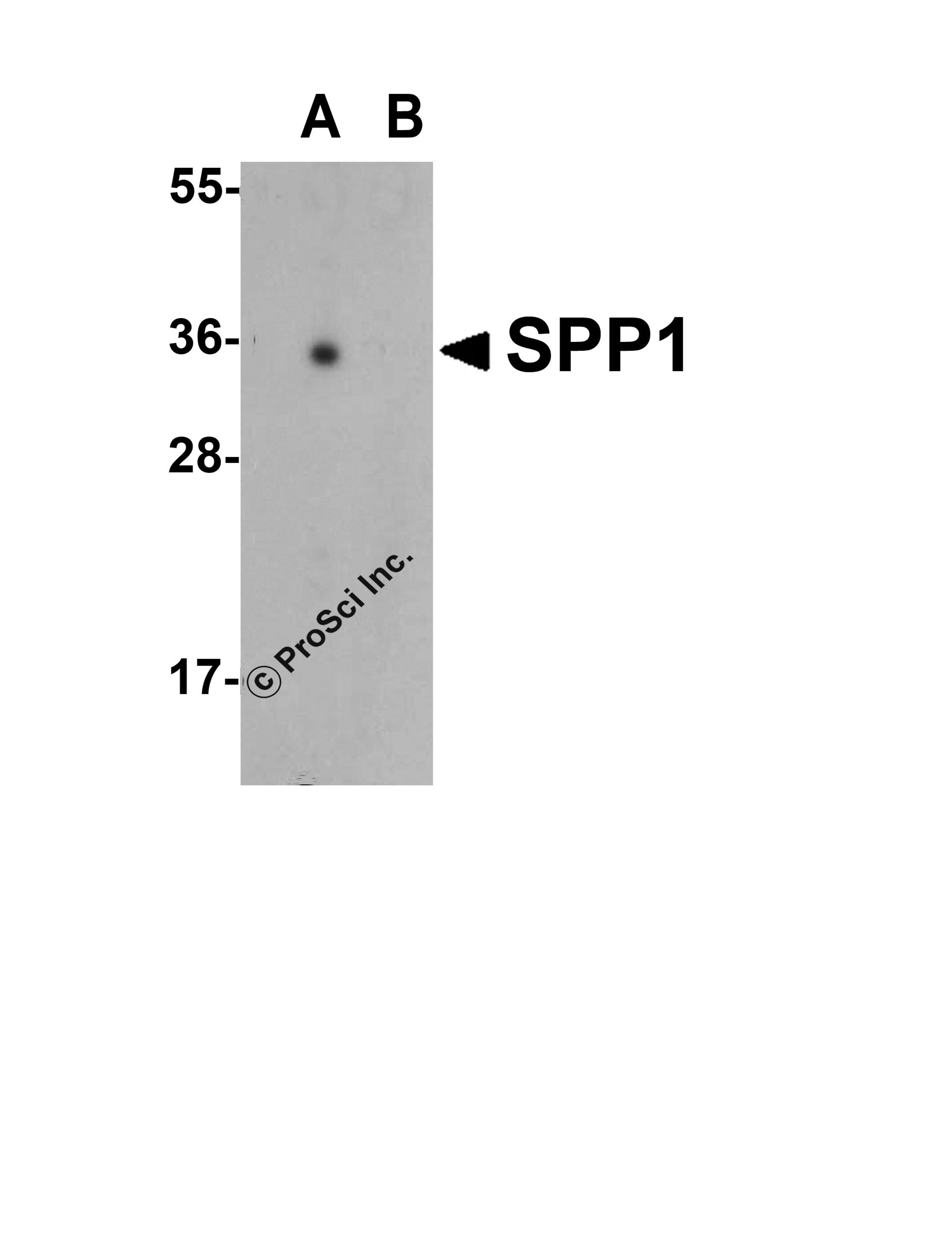 Western blot analysis of SPP1 in human bladder tissue lysate with SPP1 antibody at 1 μg/mL in (A) the absence and (B) the presence of blocking peptide