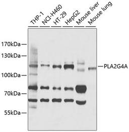 Western blot - PLA2G4A antibody (A0394)