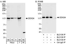 Detection of human DDX24 by western blot and immunoprecipitation.