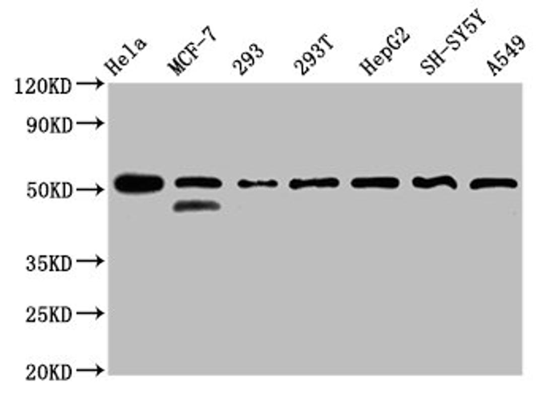 &nbsp;Western Blot. Positive WB detected in: Hela whole cell lysate, MCF-7 whole cell lysate, 293 whole cell lysate, 293T whole cell lysate, HepG2 whole cell lysate, SH-SY5Y whole cell lysate, A549 whole cell lysate. All lanes: PLAGL1 antibody at 3µg/ml. Secondary. Goat polyclonal to rabbit IgG at 1/50000 dilution. Predicted band size: 51, 45 kDa. Observed band size: 51 kDa
