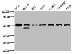 &nbsp;Western Blot. Positive WB detected in: Hela whole cell lysate, MCF-7 whole cell lysate, 293 whole cell lysate, 293T whole cell lysate, HepG2 whole cell lysate, SH-SY5Y whole cell lysate, A549 whole cell lysate. All lanes: PLAGL1 antibody at 3µg/ml. Secondary. Goat polyclonal to rabbit IgG at 1/50000 dilution. Predicted band size: 51, 45 kDa. Observed band size: 51 kDa