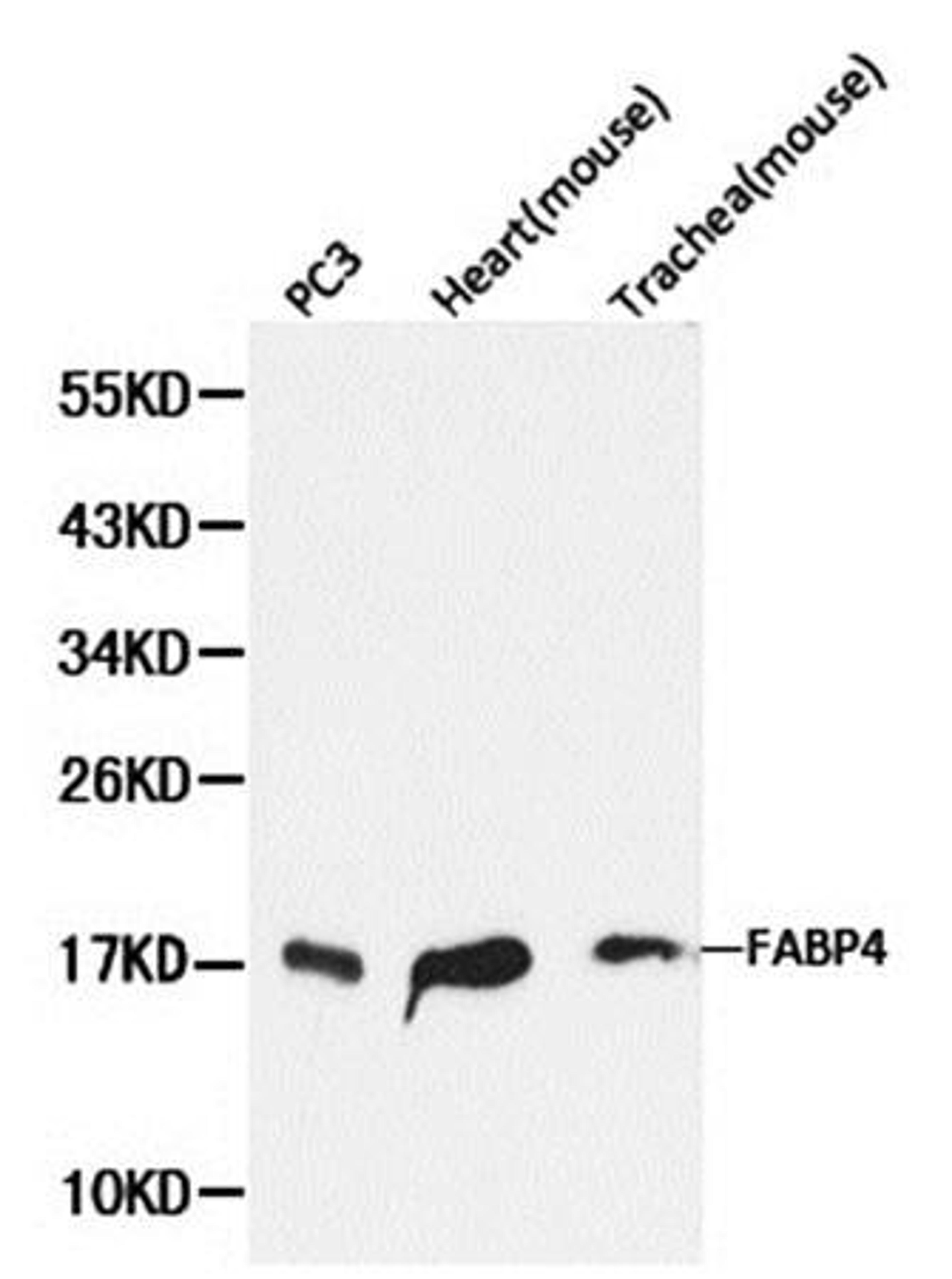 Western blot analysis of extracts of various cell line lysates using FABP4 antibody